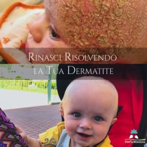 Rinasci risolvendo la Dermatite (Bimbi)